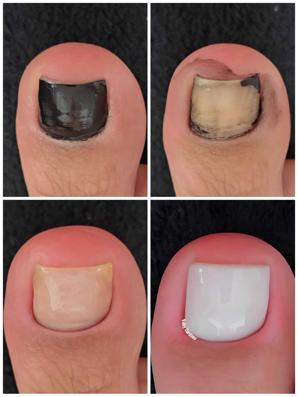 Curso Pedicure Sem Segredos melhor curso pedicure