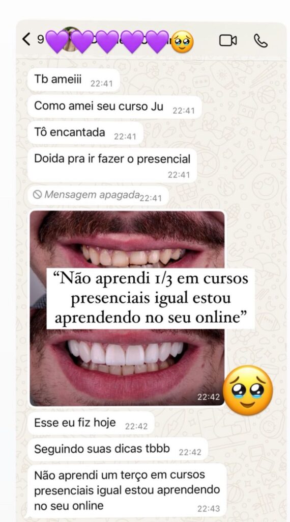 Curso Viver de Lentes em Resina  depoimentos e resultados reais