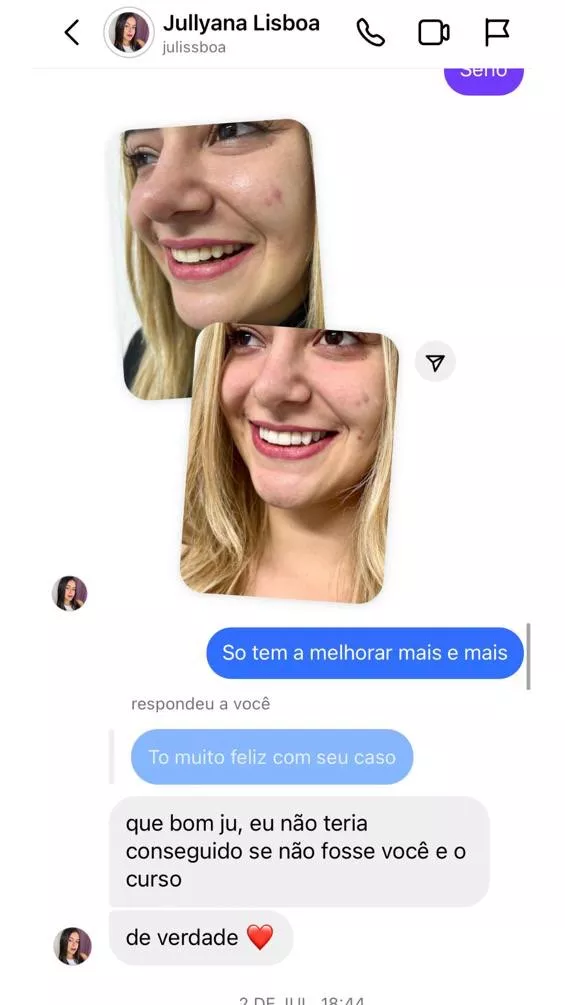 Curso Viver de Lentes em Resina  depoimentos e resultados reais