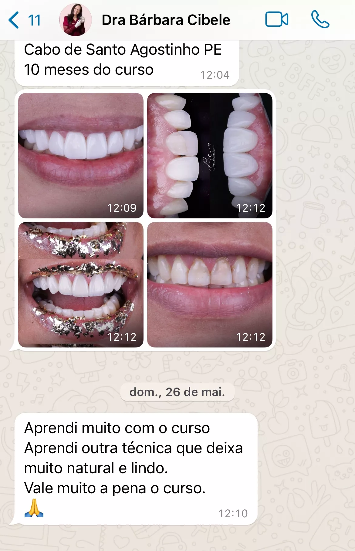 Curso Viver de Lentes em Resina  depoimentos e resultados reais