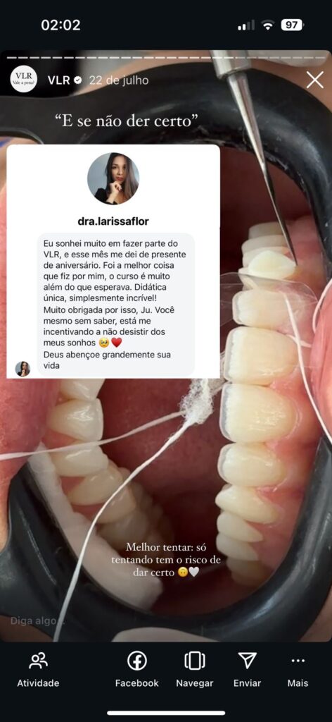 Curso Viver de Lentes em Resina  depoimentos e resultados reais