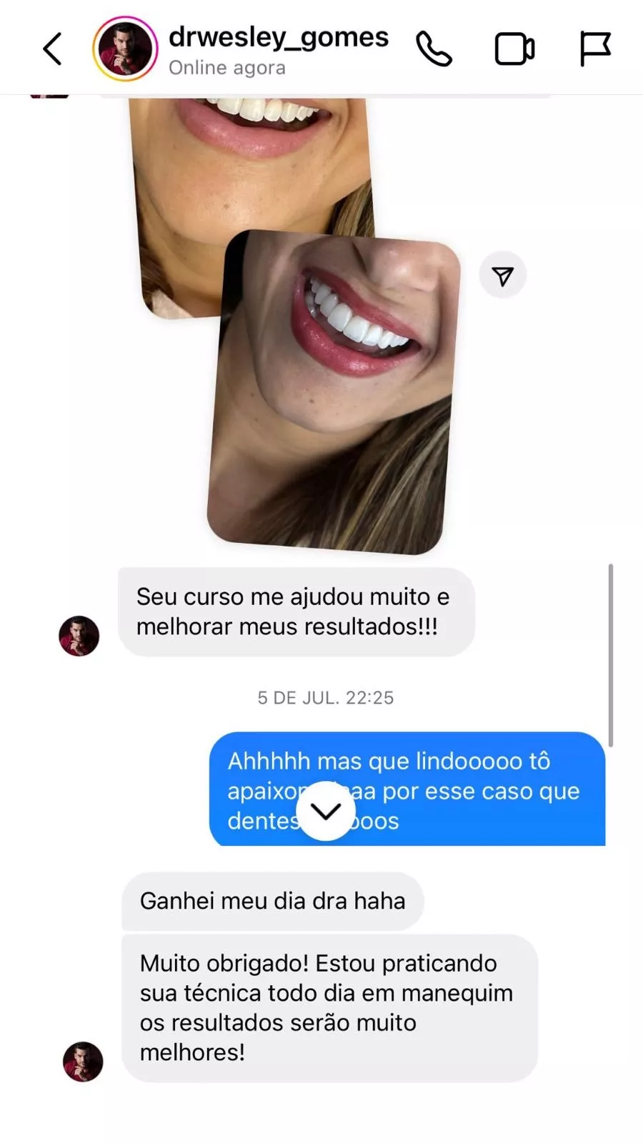 Curso Viver de Lentes em Resina  depoimentos e resultados reais